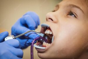 Readying teeth for braces 